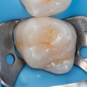 Фото с портфолио Dentoria