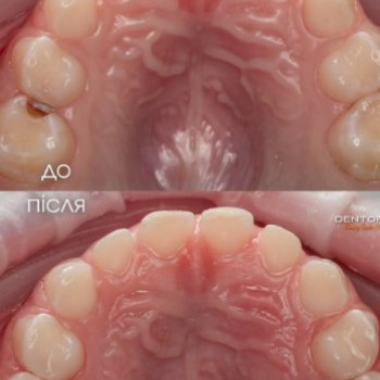 Фото с портфолио Dentoria