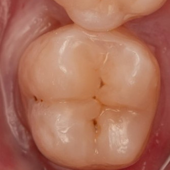 Фото с портфолио Dentoria