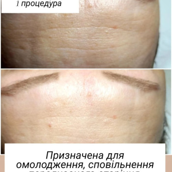 Фото с портфолио Наталія Корнієнко
