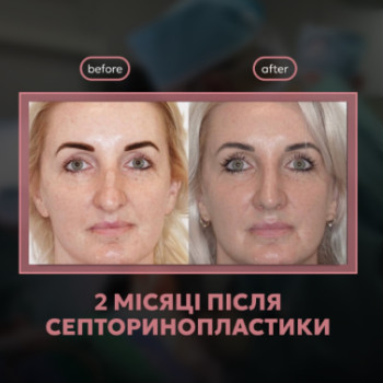 Фото с портфолио Геннадий Патлажан