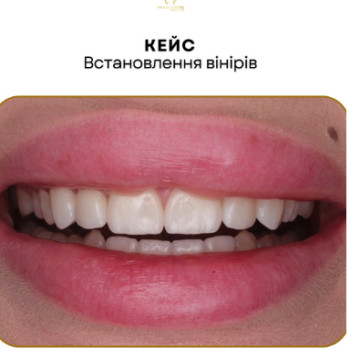 Фото с портфолио Артур Зальцведель