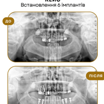 Фото с портфолио Артур Зальцведель