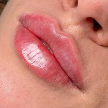 Фото с портфолио Face Look