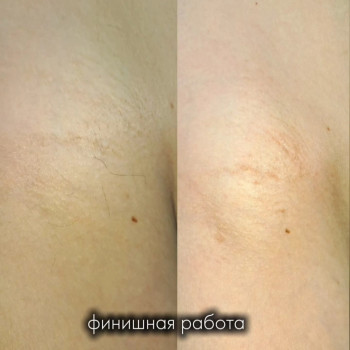 Гладенька шкіра-це саме те, чого прагнете ви. А наші майстри вам допоможуть. Чекаємо в нашій студії в Київі.