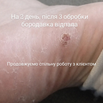 Фото с портфолио Алена Полякова