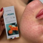 EXO PDRN 2,5 мл молодості для вашої шкіри Косметолог-инъекционист Людмила Одесса
