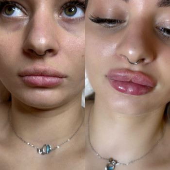 Губки