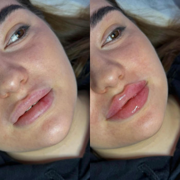 Кп губ
