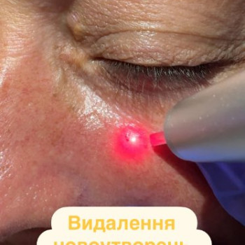 Фото с портфолио LASERCLINIC