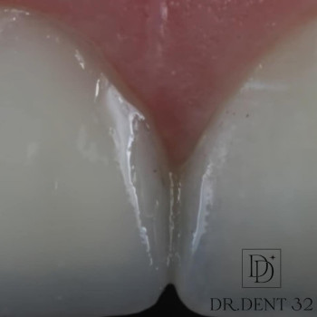 Фото с портфолио Dr. Dent 32