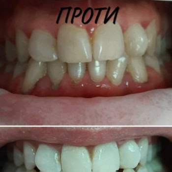 Фото с портфолио Майстерня посмішки