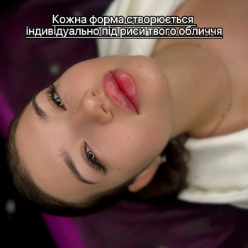 Збільшення губ