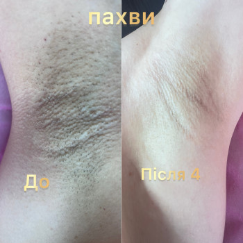Фото с портфолио Ірина Духопелова