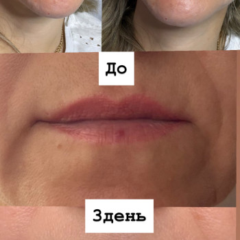 Фото с портфолио Христина Чорній