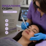 Видалення судин лазером Косметологія LASERGOOD Тернопіль