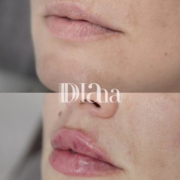 Фото с портфолио Диана Скоркина