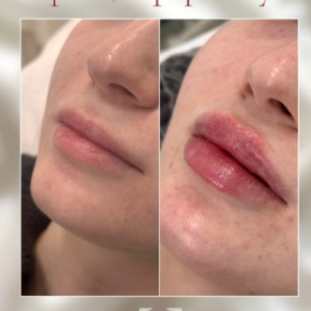 Фото с портфолио Акварель