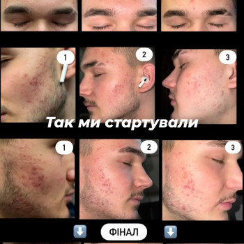 Фото с портфолио Ірина Тверда