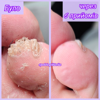 Фото с портфолио Виктория Карпенко