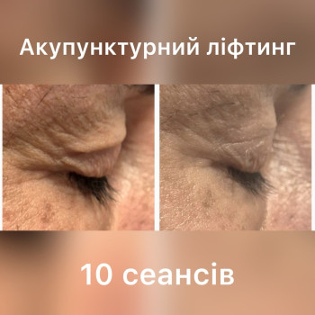 Фото с портфолио Татьяна Павлишена