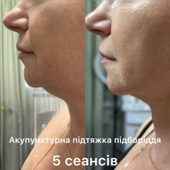 Фото с портфолио Татьяна Павлишена