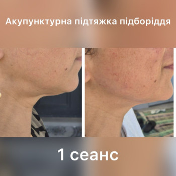 Фото с портфолио Татьяна Павлишена