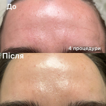 Фото с портфолио Татьяна Павлишена
