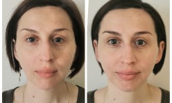Моделюючий масаж обличчя Косметолог Светлана Киев