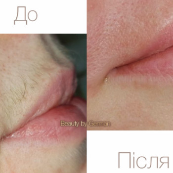Фото с портфолио Beauty studio by German