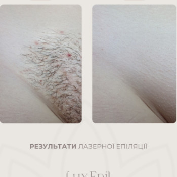 Фото с портфолио LuxEpil