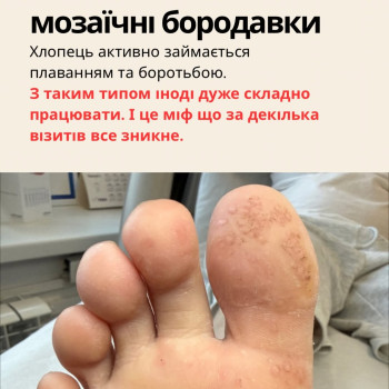 Фото с портфолио Подолог Гречана Катерина