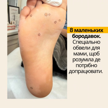 Фото с портфолио Подолог Гречана Катерина