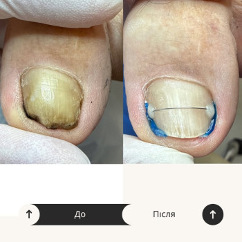 Фото с портфолио Подолог Гречана Катерина
