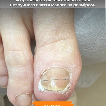 Фото с портфолио Подолог Гречана Катерина