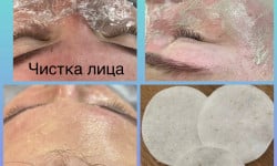 Чистка лица Майстер з пірсингу Татьяна Київ
