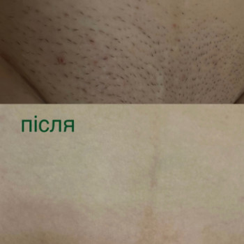 Фото с портфолио Body Beauty