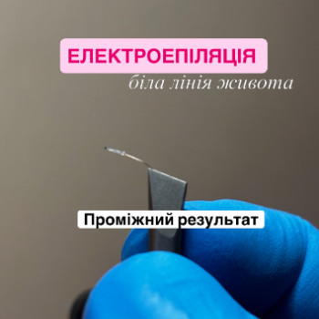 Фото с портфолио Вікторія Скороходова