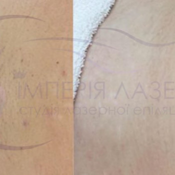 Фото с портфолио Імперія Лазер