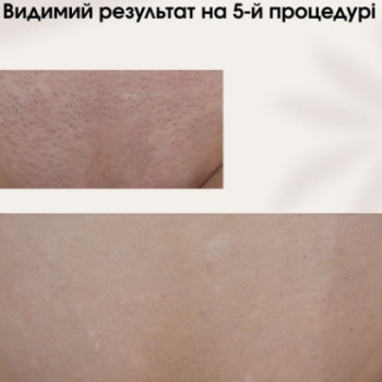 Фото с портфолио Laser For You
