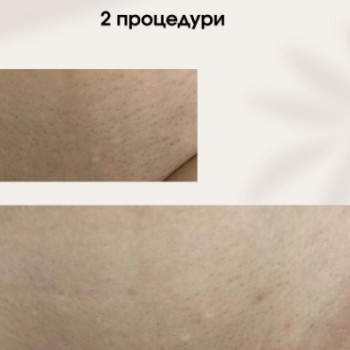 Фото с портфолио Laser For You