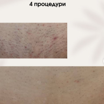 Фото с портфолио Laser For You