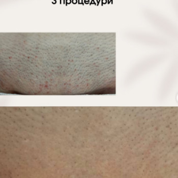 Фото с портфолио Laser For You