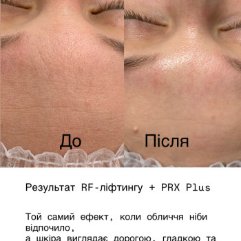 Фото с портфолио Галина Пошивак