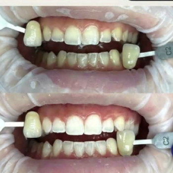 Фото с портфолио Favorite Dental clinic