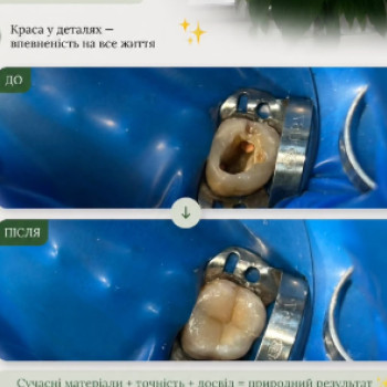 Фото с портфолио Favorite Dental clinic