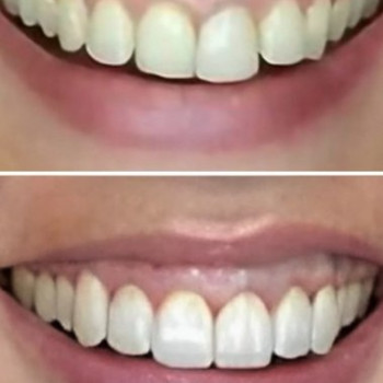 Фото с портфолио Denta Care Clinic