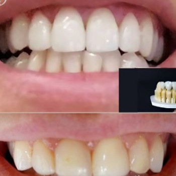 Фото с портфолио Denta Care Clinic