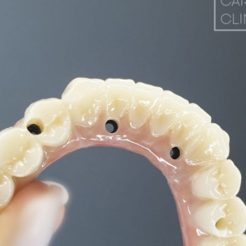 Фото с портфолио Denta Care Clinic