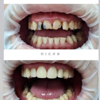 Фото с портфолио DentalProf